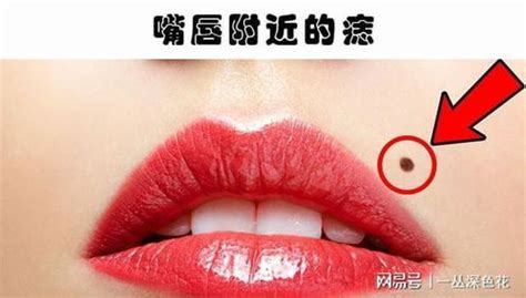 奶有痣|女人乳头周围有痣代表什么？乳头有痣的女人命好吗？